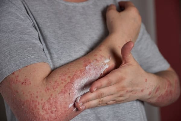 Skin & Allergy
